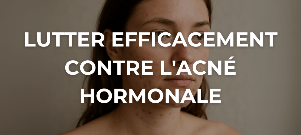 Femme adulte avec acné hormonale visible sur le menton et la mâchoire, regard neutre, fond uni.